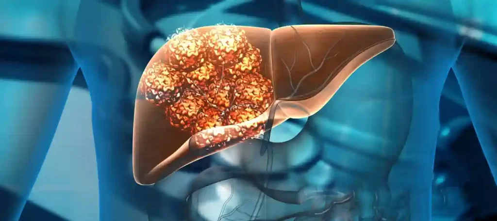 Chronic Hepatitis