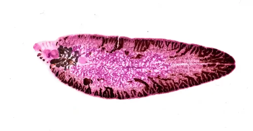 Fasciola Hepatica