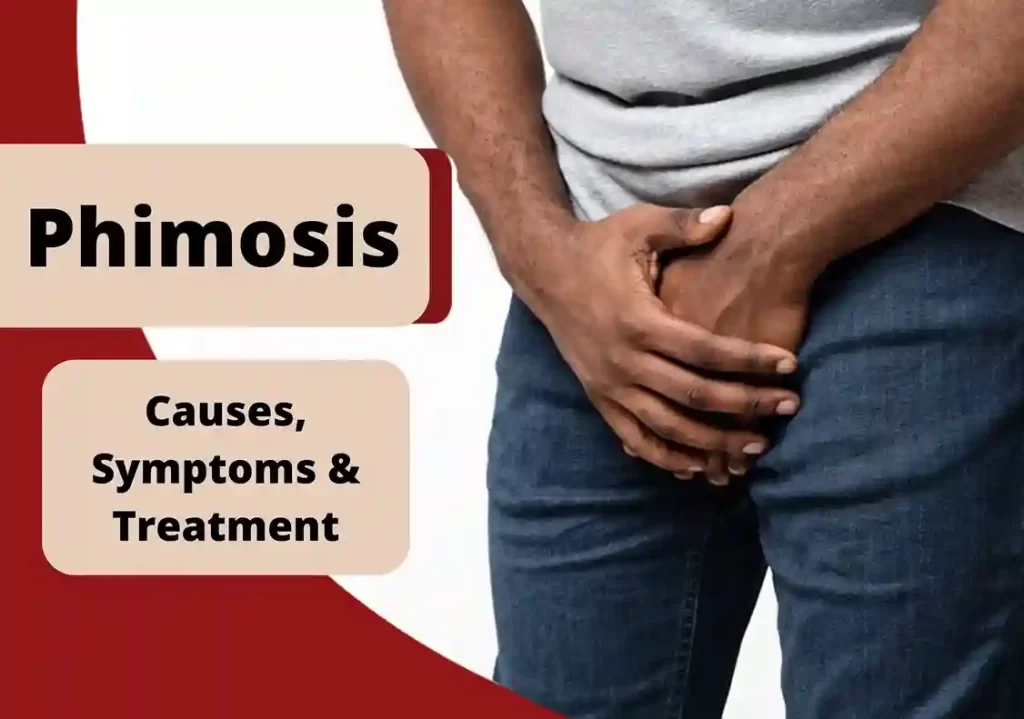 Phimosis